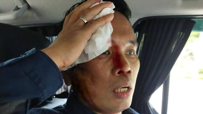 AKBP Ferikson terluka karena diduga dipukul mahasiswa Papua yang berdemo.