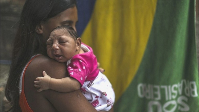 Seorang anak terjangkit Virus Zika.