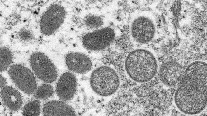Gambar virus cacar monyet lewat miskroskop