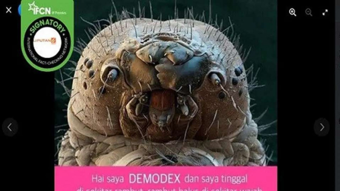 Jepretan layar sebuah foto yang diklaim sebagai Demodex, makhluk yang hidup di wajah manusia beredar, di media sosial.