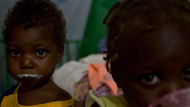 Anak-anak malnutrisi saat krisis pangan di Haiti