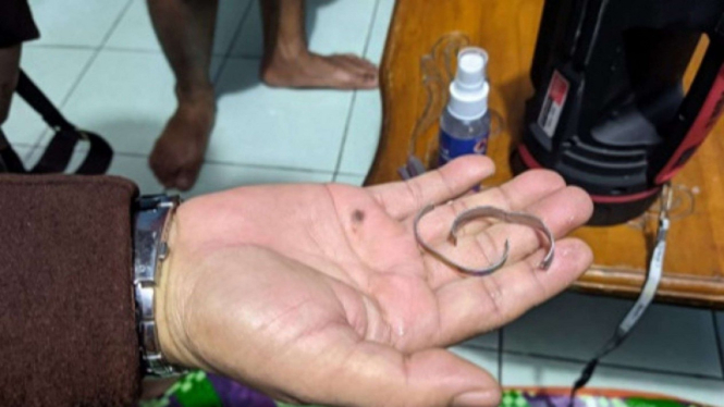Petugas Damkar berhasil lepas cincin di alat kelamin pria Sukabumi