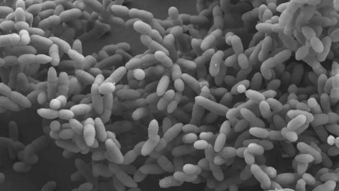Archaea yang dilihat dari mikroskop.