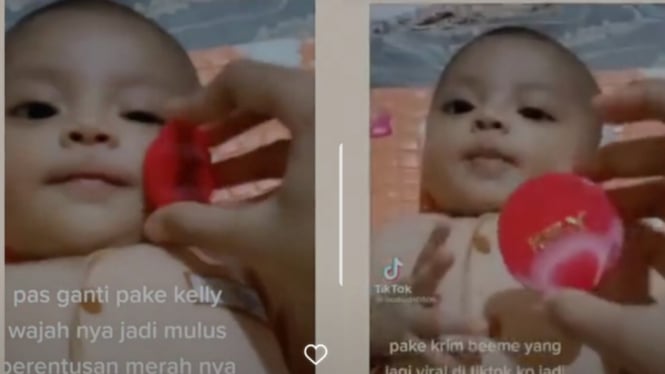 Viral bayi diberi krim wajah