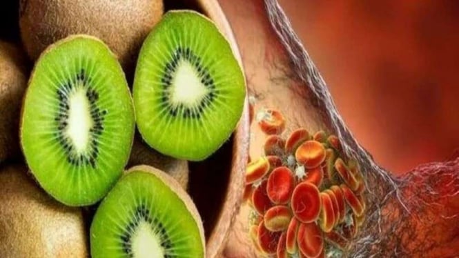 Ilustrasi buah Kiwi dan penggumpalan darah