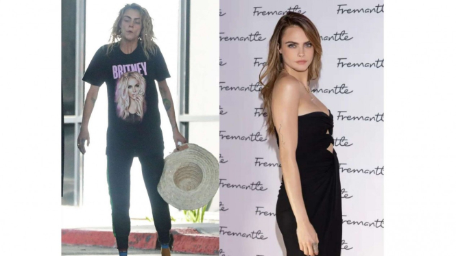 Cara Delevigne sudah tampak membaik 