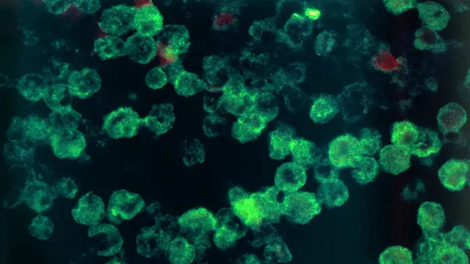 Ilustrasi amoeba