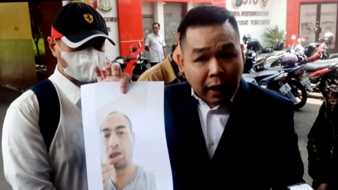 Ferry Irawan dan pengacaranya menunjukkan bukti foto bibir Ferry robek karena dicakar.