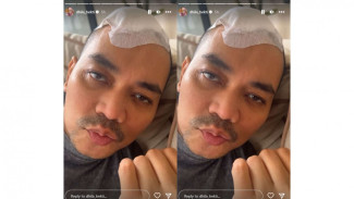 Sudah Diizinkan Pulang dari RS, Indra Bekti Masih Harus Jalani Fisioterapi