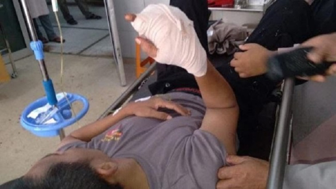 Anggota Polisi di Luwu Bripka HN terluka parah jarinya putus ditebas parang