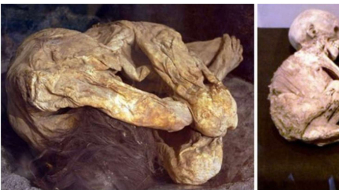 Mumi Kuno Meksiko yang Ditemukan di Garasi Rumah 