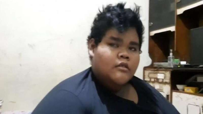 Ahmad Juwanto (19) warga Ceger, Jakarta Timur, alami obesitas bobotnya 200 kg