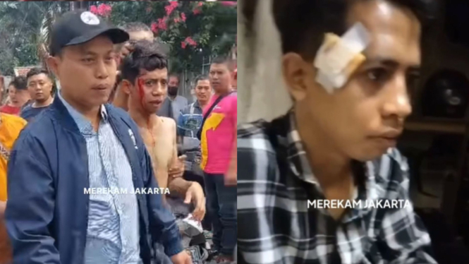 Dituding Maling Motor Gegara Punya Tato, Ridho Babak Belur Dihajar Warga