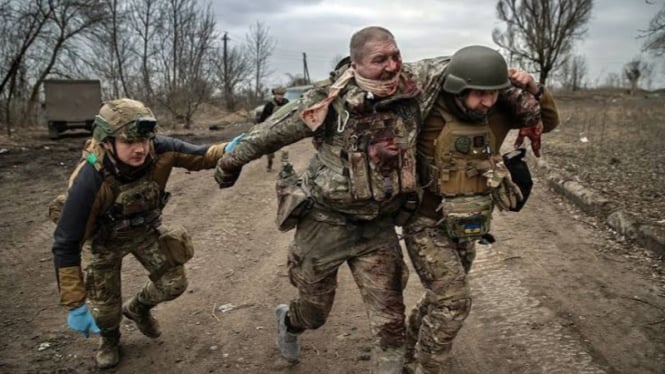 VIVA Militer: Tentara Ukraina terluka dalam pertempuran