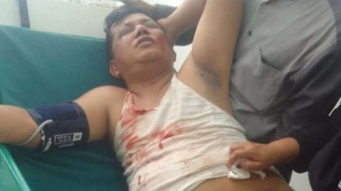 Seorang Kepala Desa di Kabupaten Bekasi Terluka Tertimpa Baliho Caleg