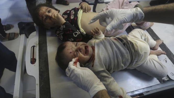 Anak-anak Palestina menerima perawatan di rumah sakit  Al-Shifa di Gaza.