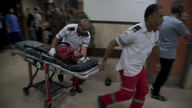 Anak-anak terluka akibat serangan bom Israel di Gaza.