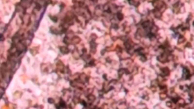 Daging babi mentah dilihat menggunakan mikroskop