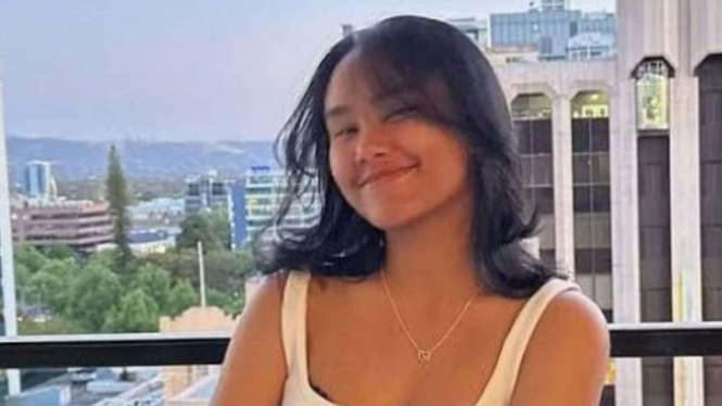 Alifia Soeryo, mahasiswa Indonesia yang tewas tertimpa batang pohon di Australia