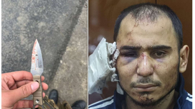 Pisau yang digunakan tentara Rusia memotong telinga tersangka teroris