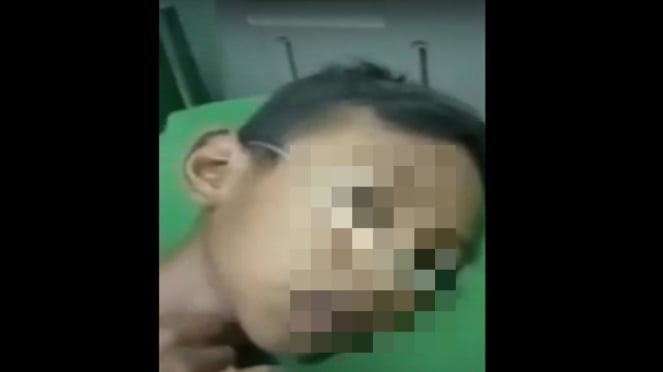 Seorang ibu di Rokan Hilir meracuni anak tirinya dengan racun tikus