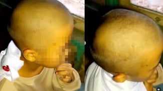 Punya Banyak Kutu, Rambut Siswi SD di Cianjur Digunduli Guru Tanpa Izin Orang Tua