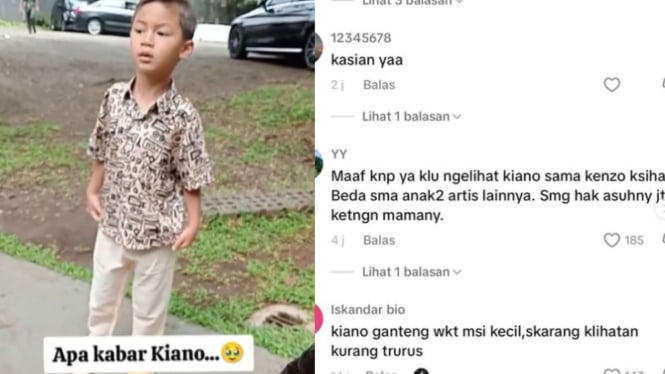 Penampilan Memprihatinkan Kiano Usai di Asuh oleh Baim Wong