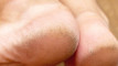 Photo Mini 1