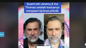 Oplas di Korea Selatan, Begini Wajah Jeremy Thomas Sekarang