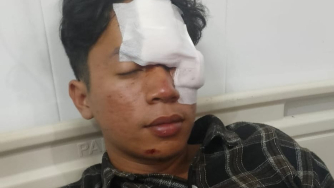 Pasien kecelakaan, M Syaiful Hadi (28), menjadi korban penikaman saat berada di ruang IGD RSMH Palembang.