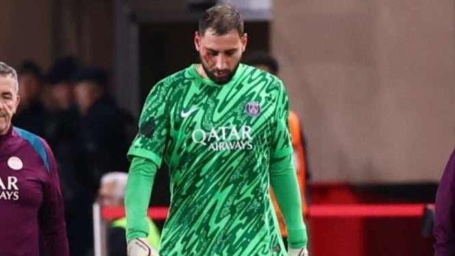 Kiper PSG Gianluigi Donnarumma cedera di wajah