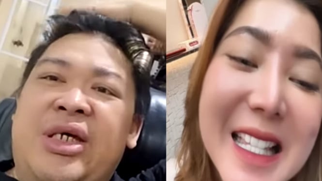 Pedas! Pratiwi Noviyanthi Sindir Alvin Lim: Gigi Saya Bersih