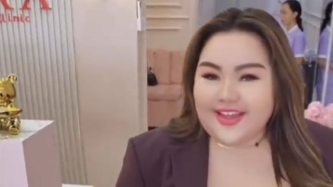 Lisa Mariana Angkat Bicara Soal Perubahan Fisiknya yang Disebut Makin Gemoy