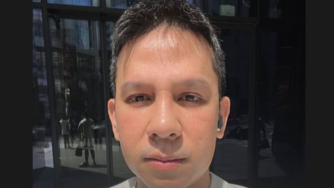 Gak Mau Bohong, Jordi Onsu Tak Jadikan Sinus Sebagai Alasan Oplas Hidung