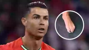 Kuku kaki Ronaldo yang berwarna hitam jadi sorotan