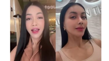 Denada sebelum dan sesudah operasi