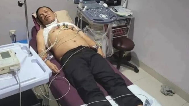 Viral Foto Wamenaker Immanuel Ebenezer Terbaring Dipasang Alat EKG, KPK Merespons