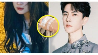 Aktris Sun Lin Alami Cedera Usai Singgung Kematian Yu Menglong Bukan Kecelakaan