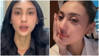 Yuenchi Arwindi Bantah Isu Jadi Simpanan Eks Jampidsus Febrie Adriansyah, Apa Profesi Aslinya?